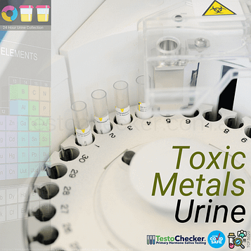 toxic metals test.urine.image